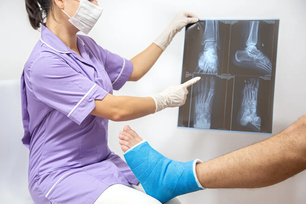 Tratamiento de fracturas en Nuevo Leon